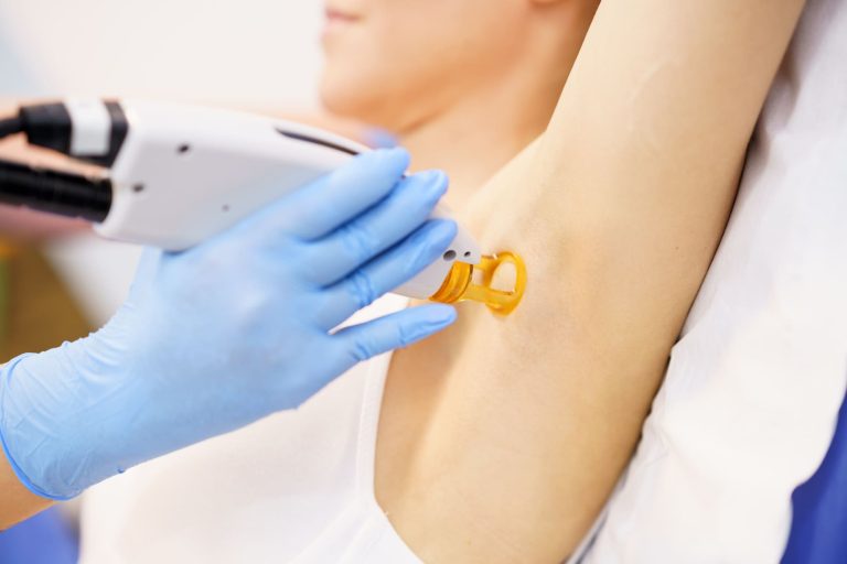 woman-receiving-underarm-laser-hair-removal-at-a-b-2023-11-27-05-20-54-utc (1) (1)