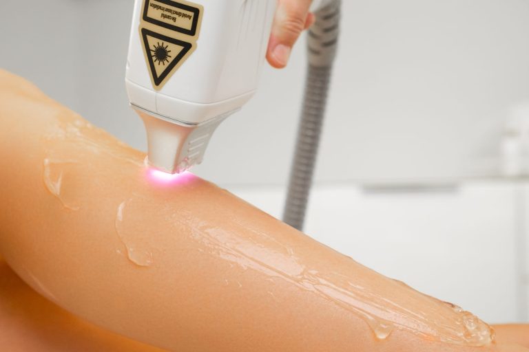 expert-does-laser-hair-removal-of-leg-with-smeared-2023-11-28-01-27-52-utc 1 1